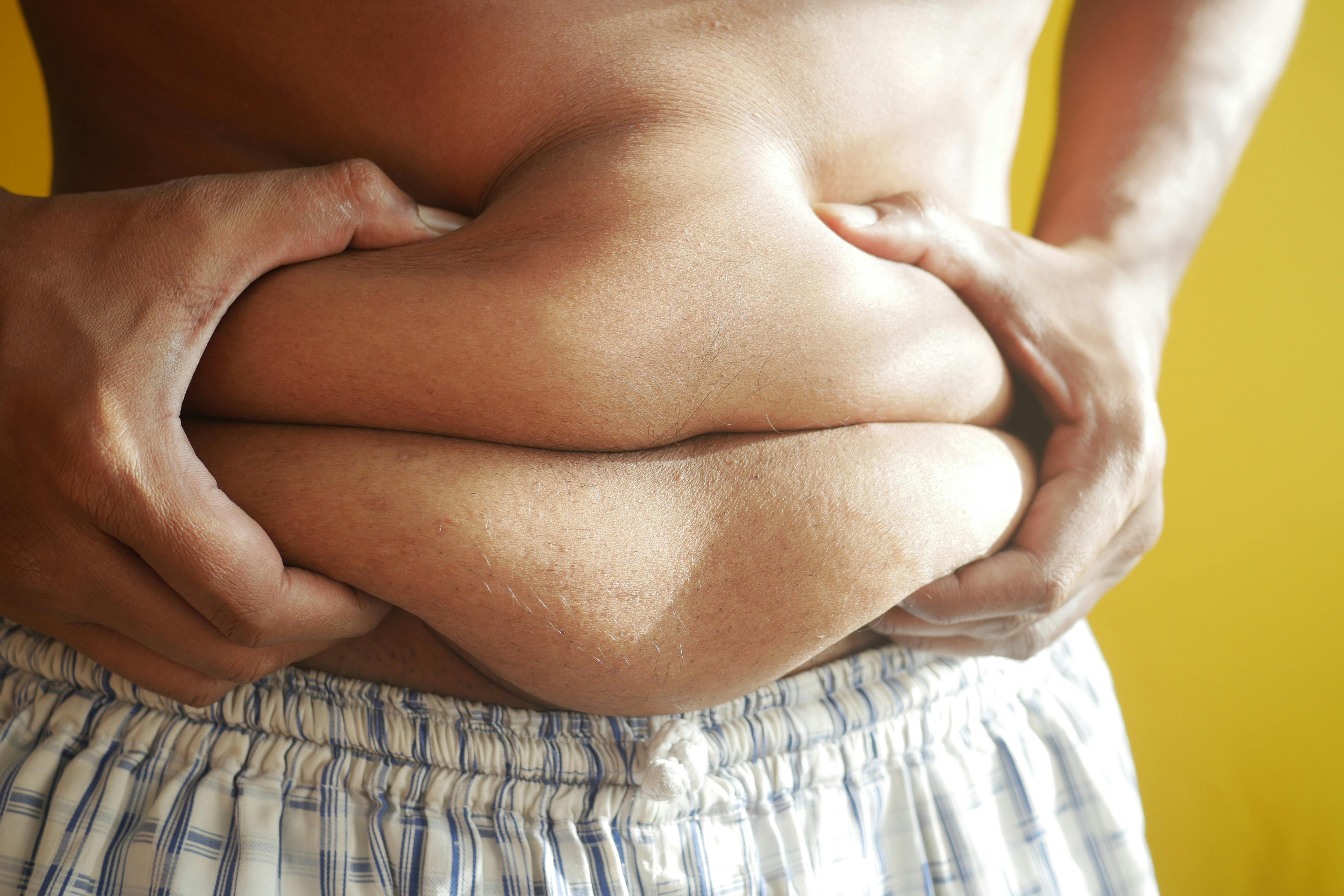 A person holding their stomach, highlighting folds and skin texture against a bright background.