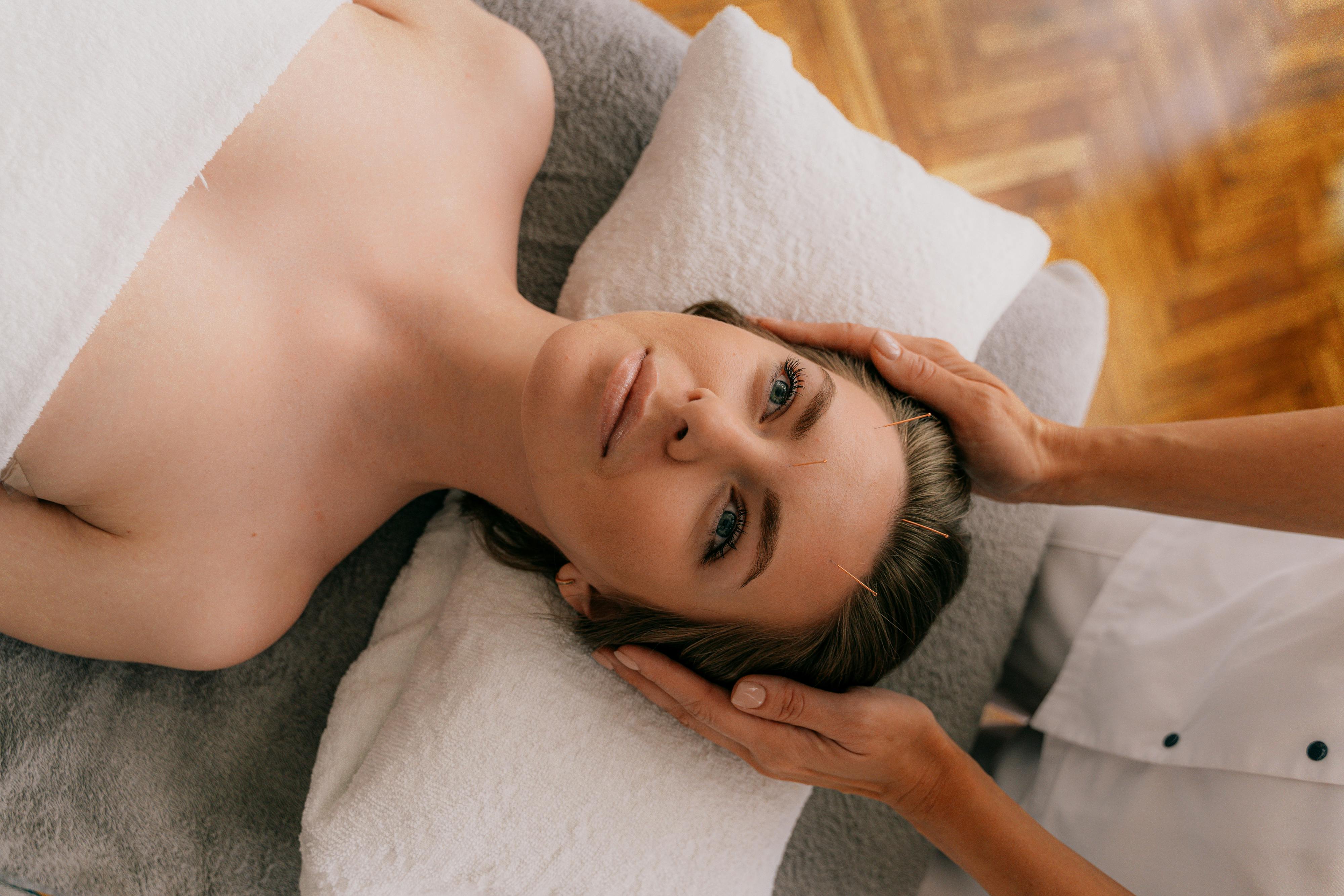 Woman receiving acupuncture therapy in a serene, indoor setting for wellness enhancement